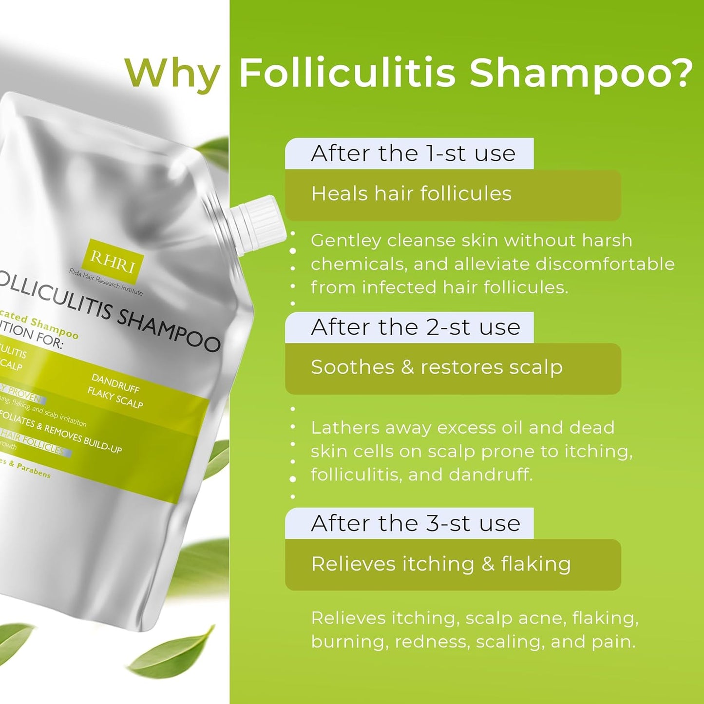 Anti Fungal Shampoo for Folliculitis, Seborrheic Dermatitis, Dandruff, Scalp Psoriasis & Itchy Dry Scalp Relief